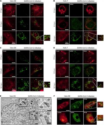 SARS-CoV-2 Causes Mitochondrial Dysfunction and Mitophagy Impairment